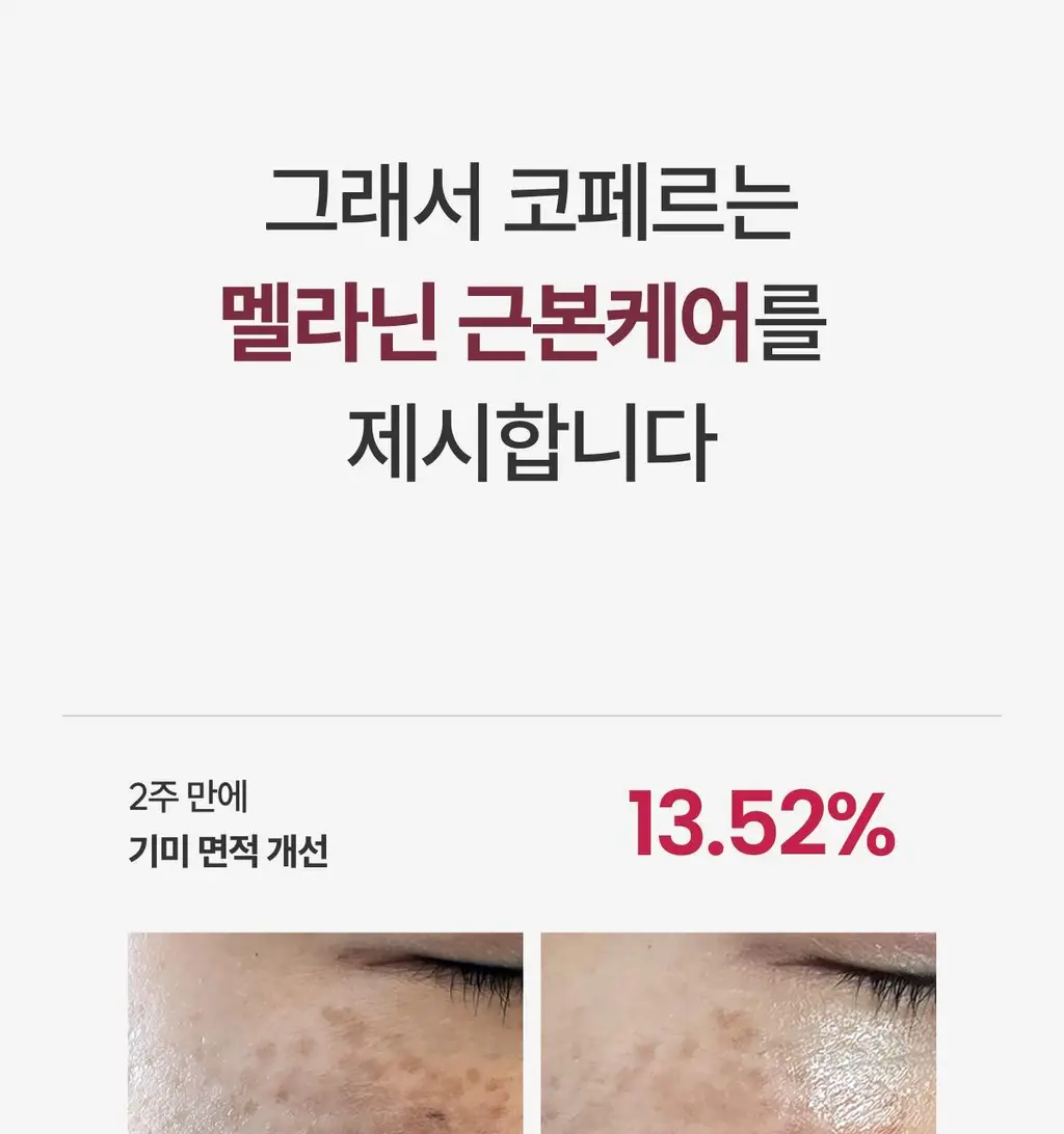 [사니엘블랑 PICK] 코페르 큐리페어 멜더 에스오에스 시스템 5개입 (1.5ml*5ea) 상세페이지 30